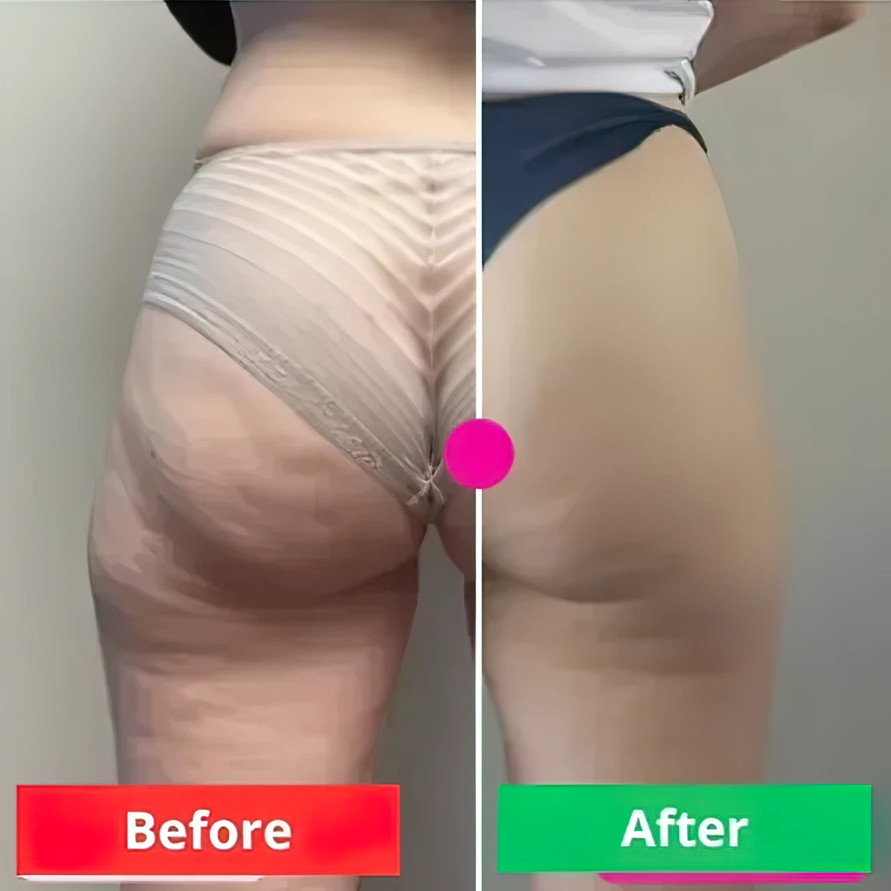 ADEUSMulti-ActionBodyCream300g_FirmsSkin_ReducesCellulite_StretchMarks_Bumps_Vegan_Fast-AbsorbingHydratingFormula_10_640x640-gigapixel-very_compressed-scale-2_00x