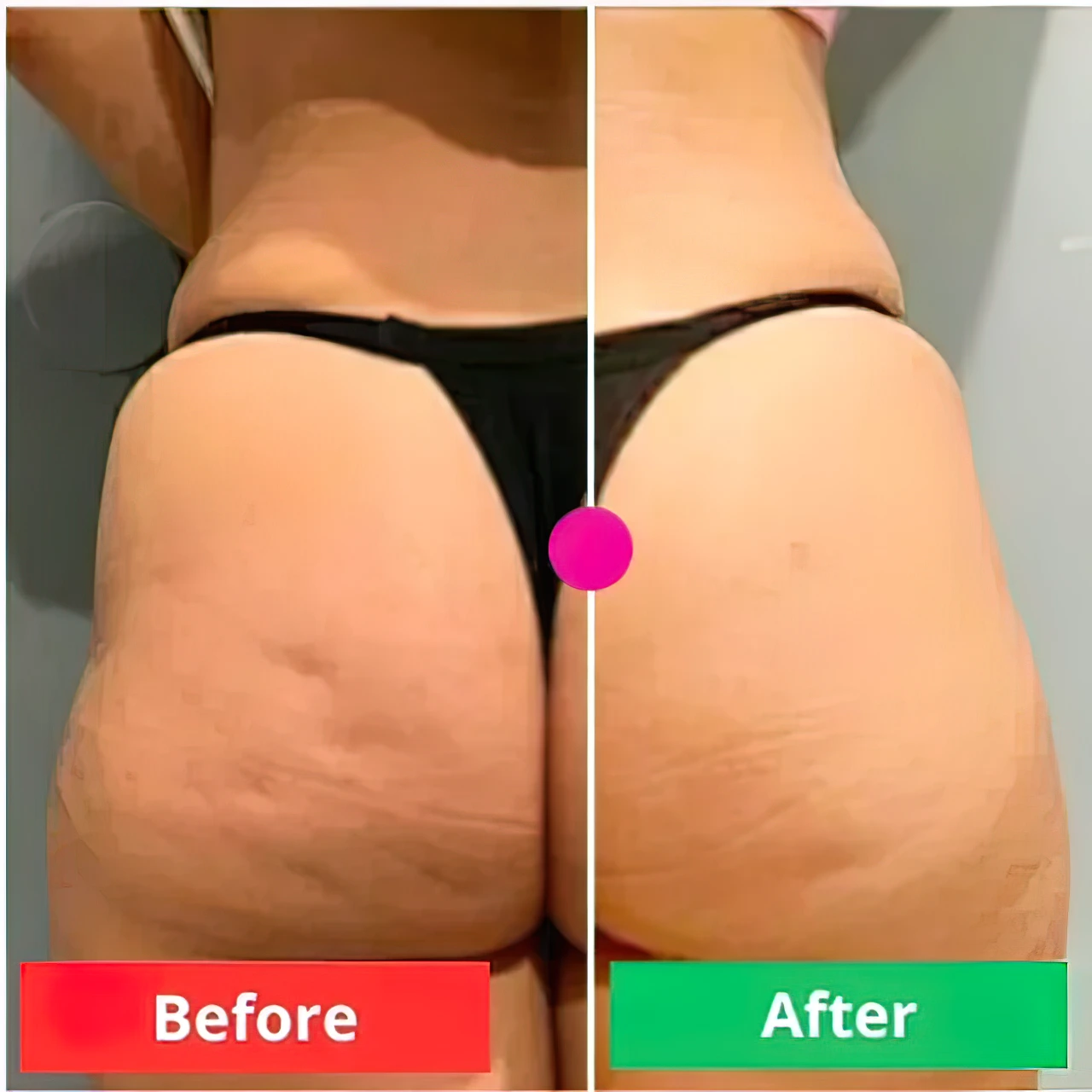 ADEUSMulti-ActionBodyCream300g_FirmsSkin_ReducesCellulite_StretchMarks_Bumps_Vegan_Fast-AbsorbingHydratingFormula_4_640x640-gigapixel-very_compressed-scale-2_00x