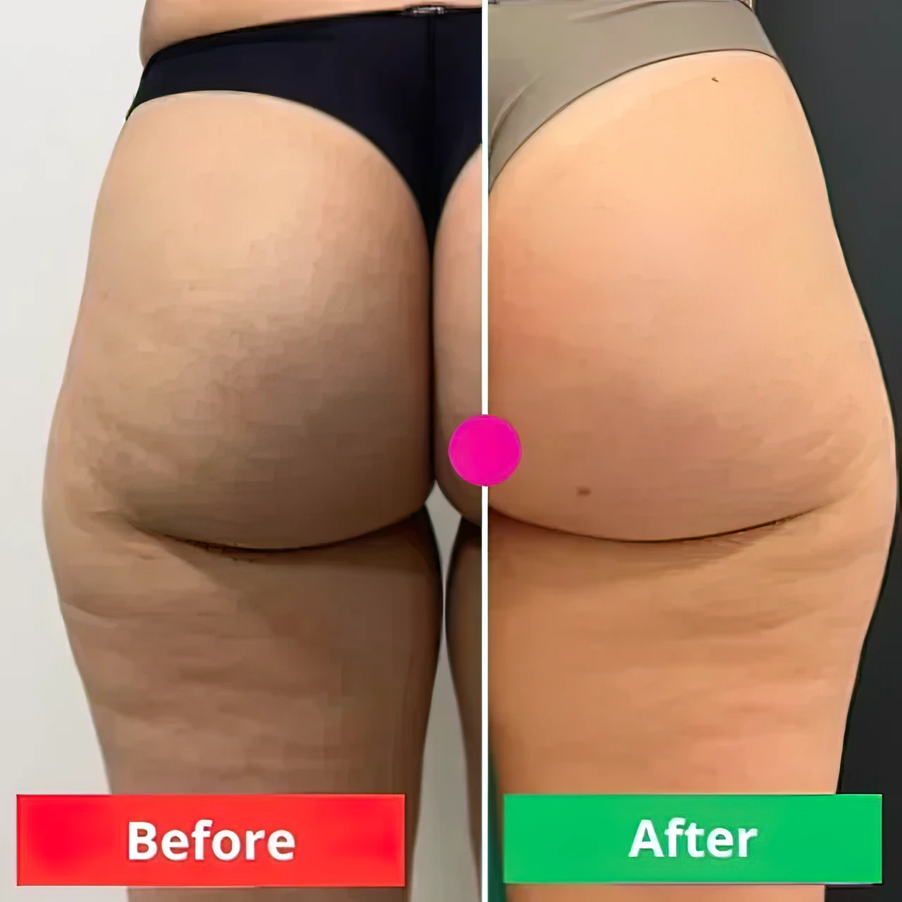 ADEUSMulti-ActionBodyCream300g_FirmsSkin_ReducesCellulite_StretchMarks_Bumps_Vegan_Fast-AbsorbingHydratingFormula_8_640x640-gigapixel-very_compressed-scale-2_00x