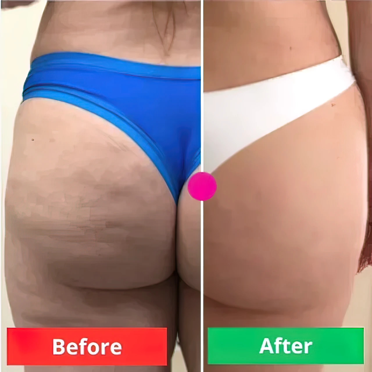 ADEUSMulti-ActionBodyCream300g_FirmsSkin_ReducesCellulite_StretchMarks_Bumps_Vegan_Fast-AbsorbingHydratingFormula_9_640x640-gigapixel-very_compressed-scale-2_00x